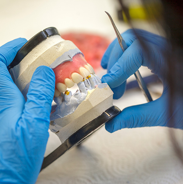 Edmonton denture clinic Complete Dentures